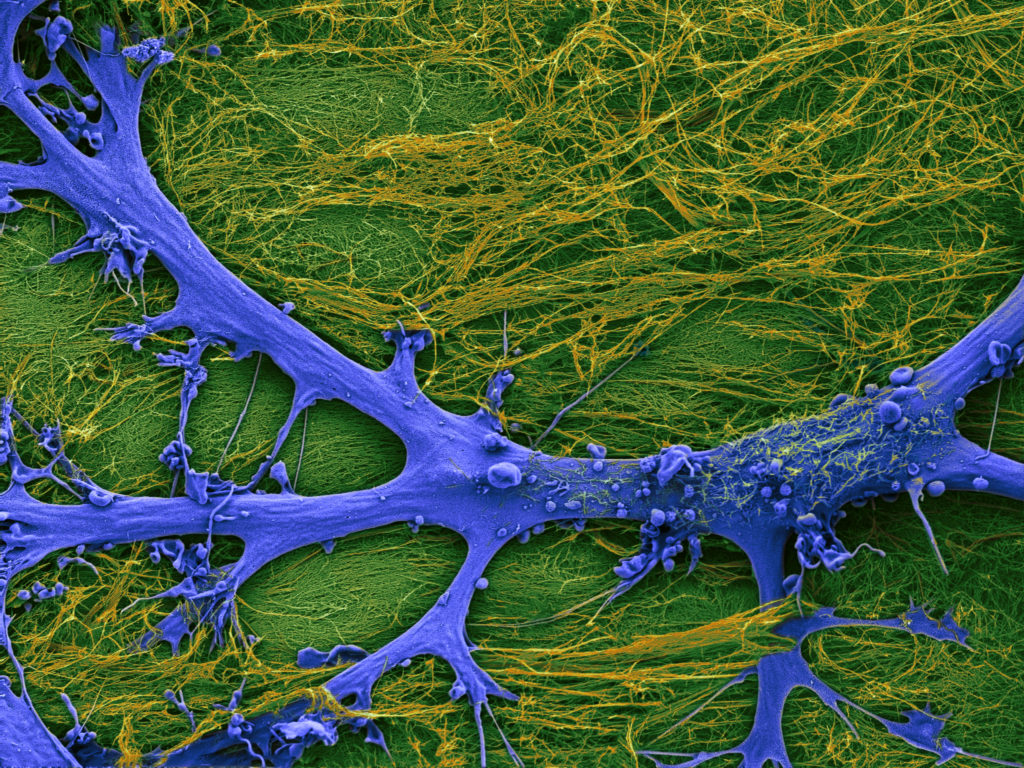 The image depicts the interaction between a brain cell known as astrocyte (shown in blue) and a synthetic material (shown in green) that mimics the extracellular environment. The material made of peptides and DNA forms fibrous bundles (highlighted in yellow) that are similar to the ones present in the spinal cord when an injury occurs.