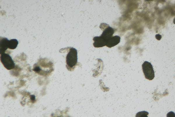 Tardigrades under a microscope